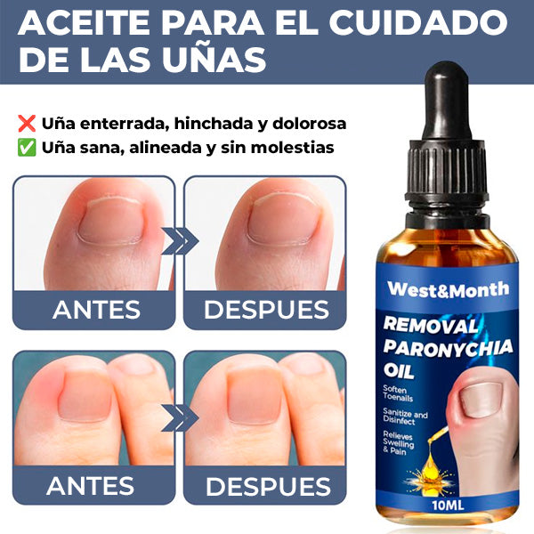 Esencia Erradicadora de Hongos | Reparadora de uñas + REGALO