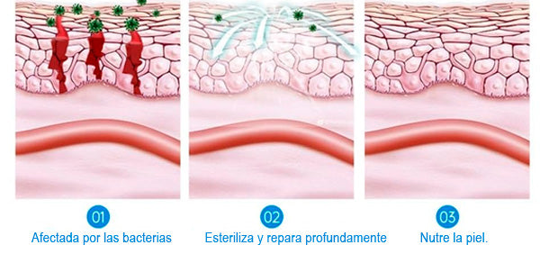 Crema Antibacterial Íntima Dermxpert | Alivia Picazón, Hongos y Ardor – Apta para Mujeres y Hombres