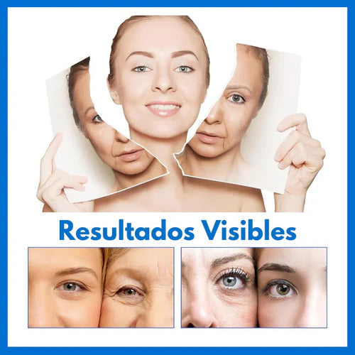 Paga 1 Lleva 2 Botox Stock Solution Suero Antiarrugas + REGALO