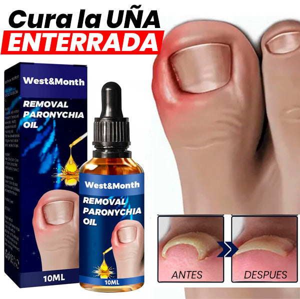 Esencia Erradicadora de Hongos | Reparadora de uñas + REGALO