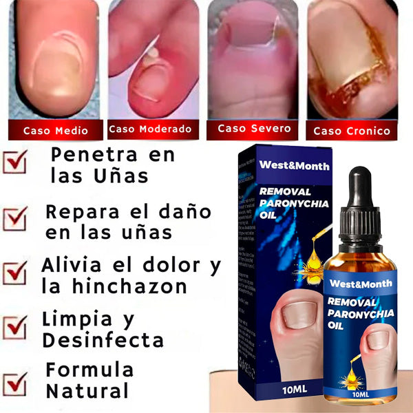 Esencia Erradicadora de Hongos | Reparadora de uñas + REGALO