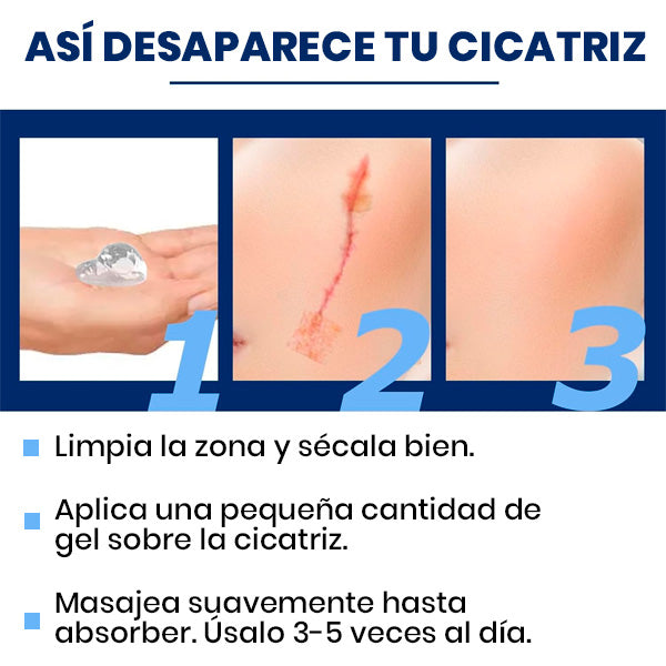 GEL DE SILICONA PARA CICATRICES ESTRÍAS QUELOIDES QUEMADURAS