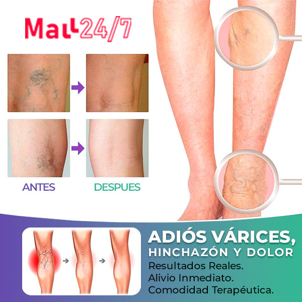 Combo Medias de Compresión + Gel Antivárices VEINS | Alivio Inmediato para Piernas Hinchadas y con Dolor