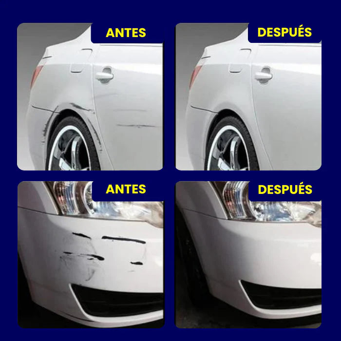 Quita Rayones + Envío GRATIS