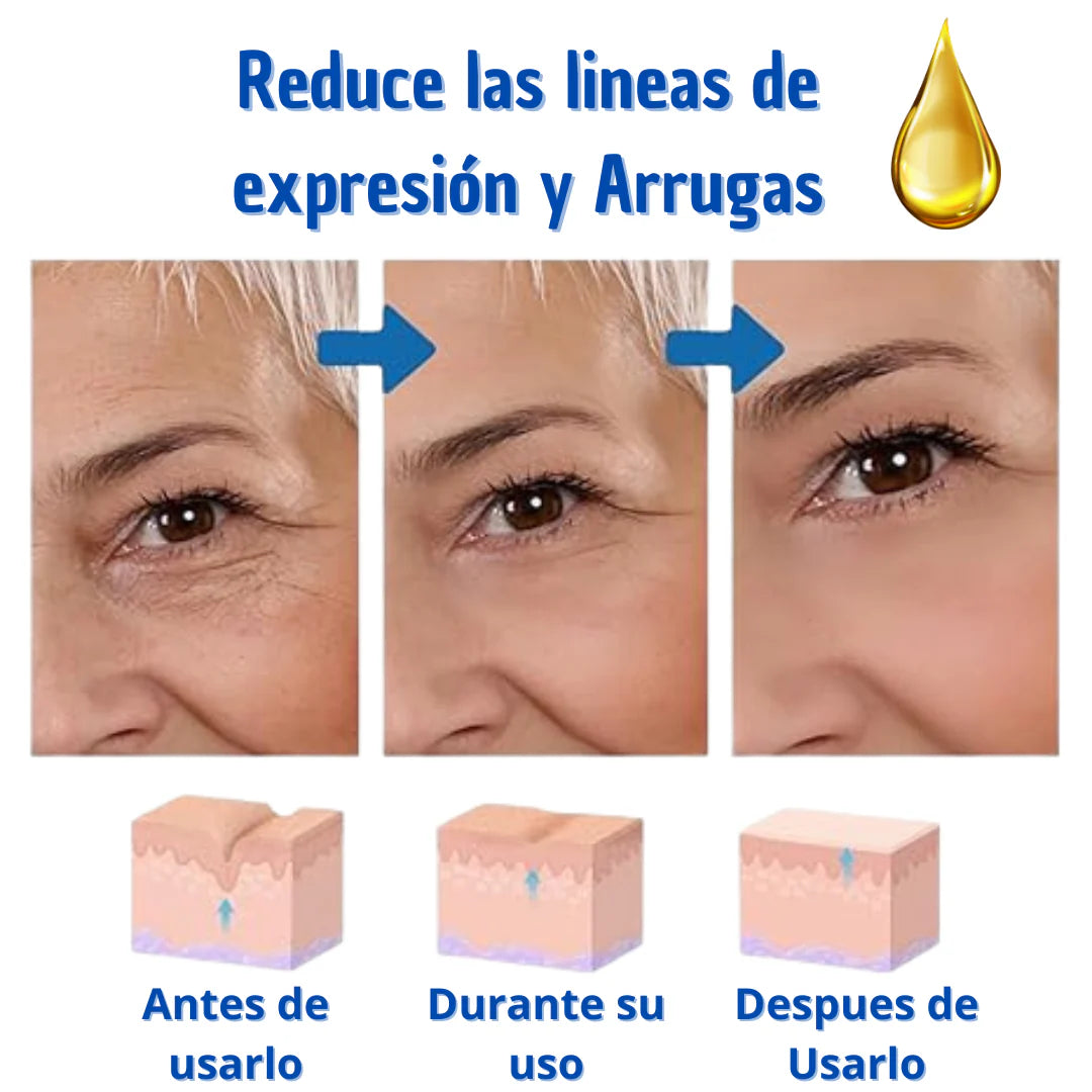 Paga 1 Lleva 2 Botox Stock Solution Suero Antiarrugas + REGALO