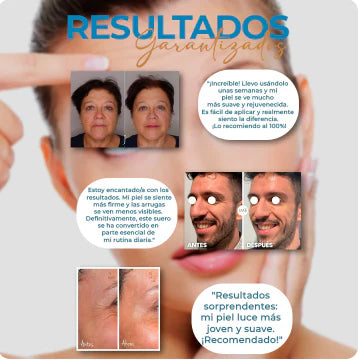 Paga 1 Lleva 2 Botox Stock Solution Suero Antiarrugas + REGALO