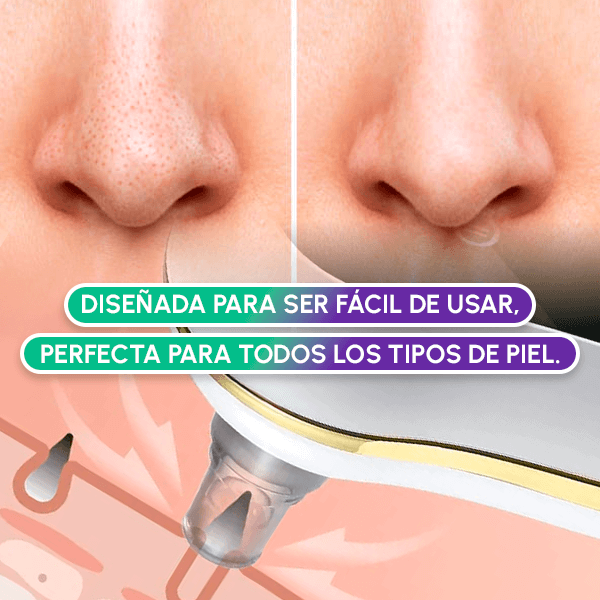 Extractor de espinillas + OBSEQUIO