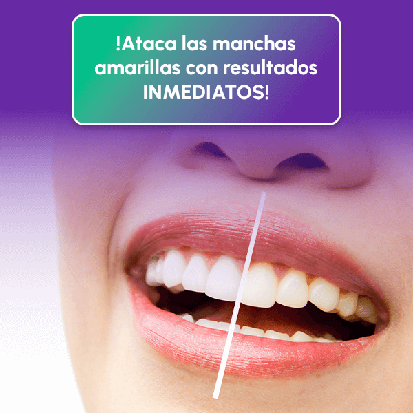 Pague 1 Leve 2 Lápiz Blanqueador Dental - DAZZLING WHITE + Envío GRATIS