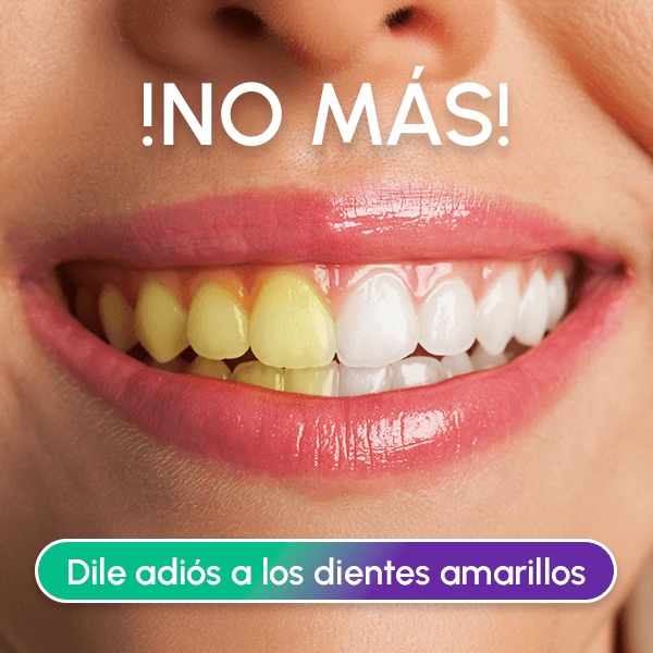 Pague 1 Leve 2 Lápiz Blanqueador Dental - DAZZLING WHITE + Envío GRATIS