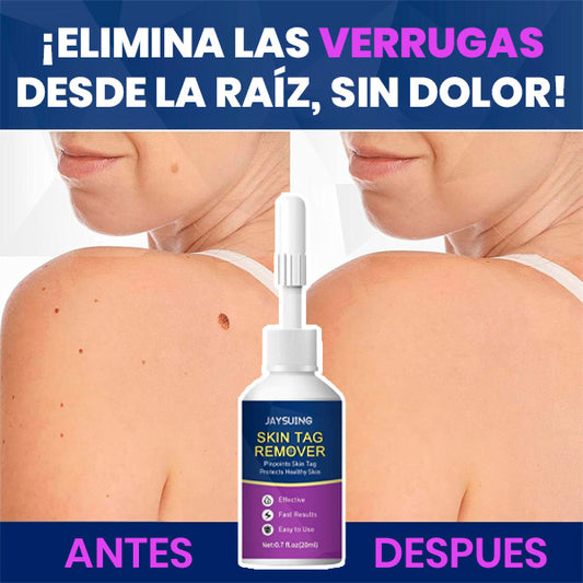 Eliminador de verrugas líquido de acción rápida