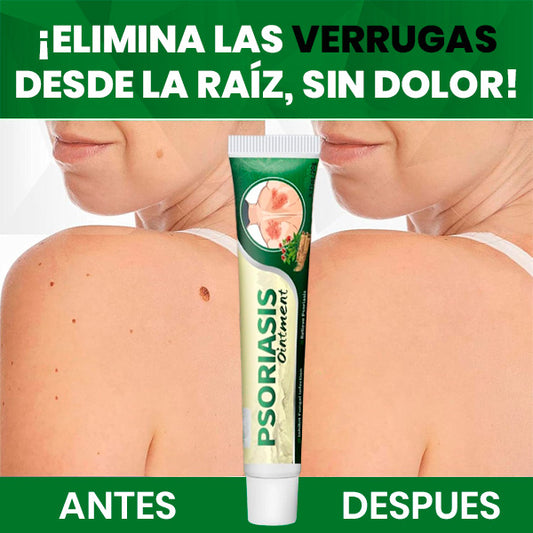 Crema Quita Verrugas Rápido y Sin Dolor | Tratamiento en Casa + REGALO