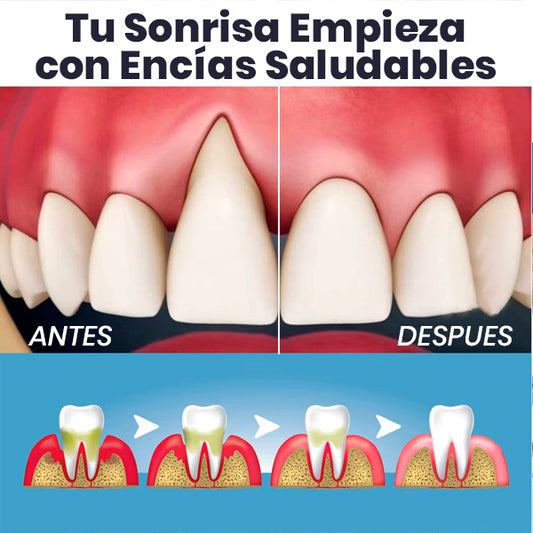 Blanqueador  Dental Instantáneo para Encías Inflamadas - Elimina Manchas y Cuida Encías