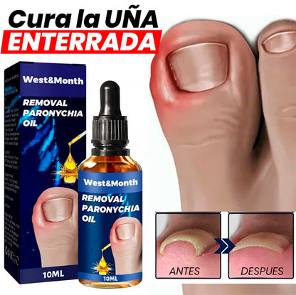 Esencia Erradicadora de Hongos | Reparadora de uñas + REGALO