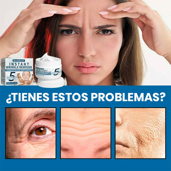 Crema Facial AntiARRUGAS-Blanqueadora con Retinol 30ml