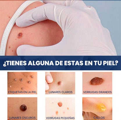 Crema Quita Verrugas Rápido y Sin Dolor | Tratamiento en Casa + REGALO