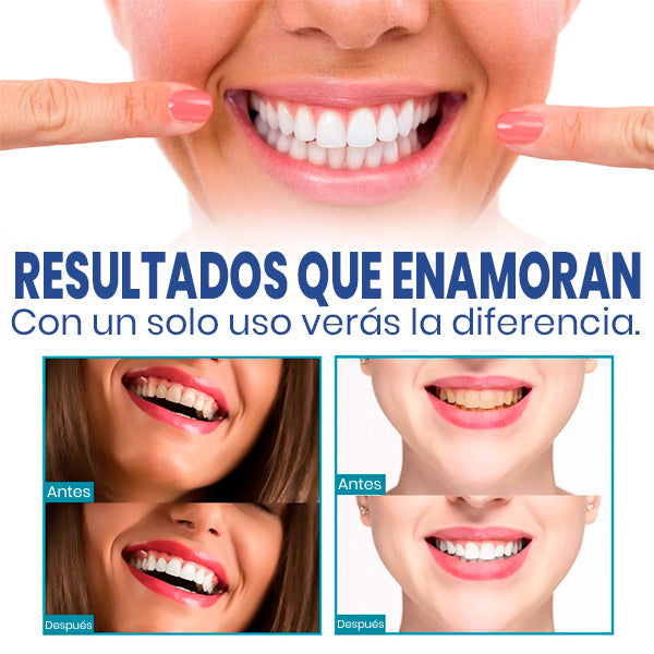 Blanqueador  Dental Instantáneo para Encías Inflamadas - Elimina Manchas y Cuida Encías