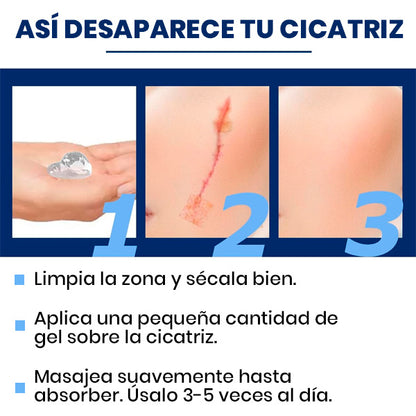 GEL DE SILICONA PARA CICATRICES ESTRÍAS QUELOIDES QUEMADURAS