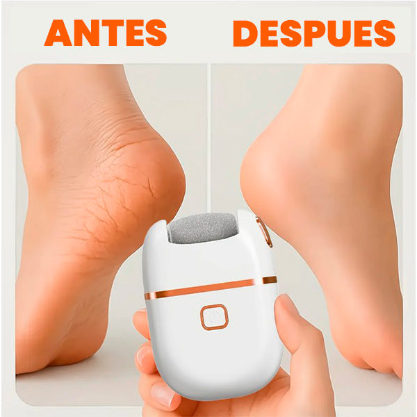 Removedor de Callos Recargable | Pies Suaves y Sin Durezas