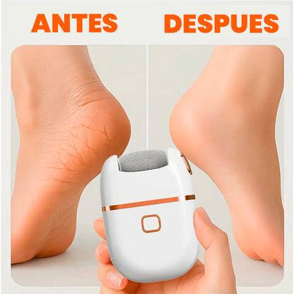 Removedor de Callos Recargable | Pies Suaves y Sin Durezas