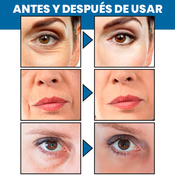 Crema Facial AntiARRUGAS-Blanqueadora con Retinol 30ml