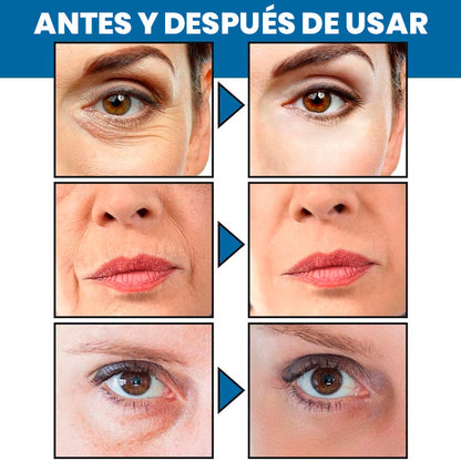 Crema Facial AntiARRUGAS-Blanqueadora con Retinol 30ml
