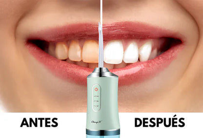 limpieza profunda con Irrigador bucal portátil + REGALO