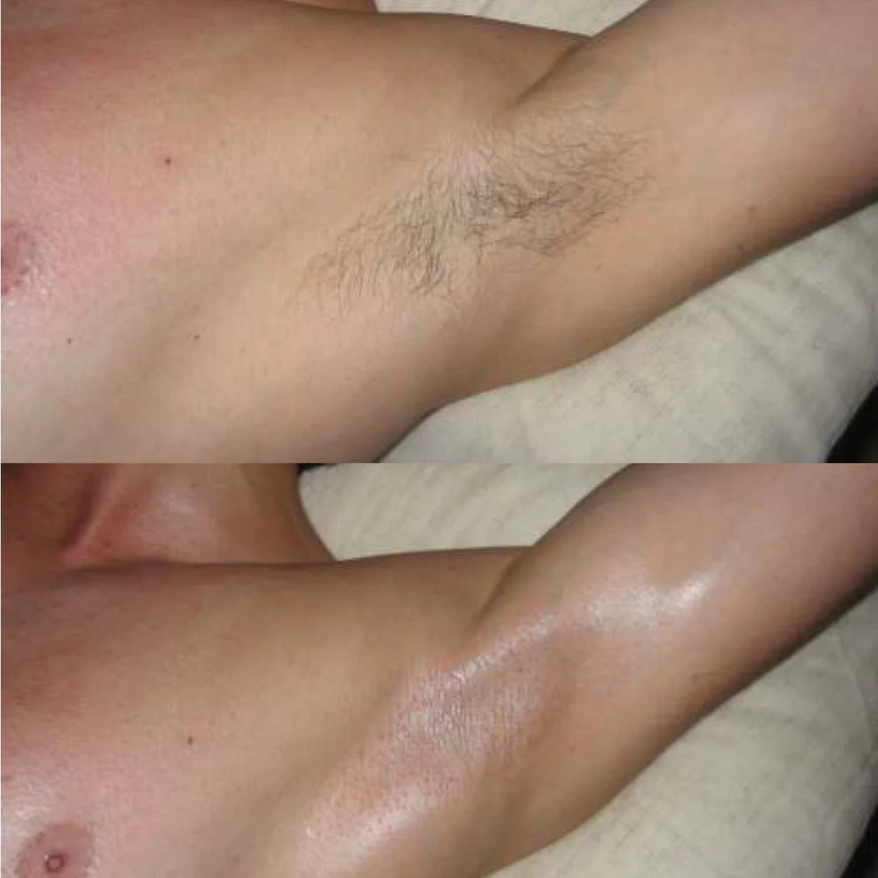 Crema depiladora + Envio Gratis