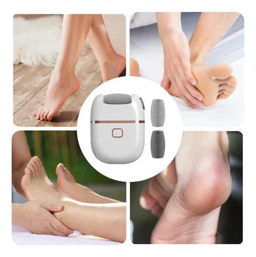 Removedor de Callos Recargable | Pies Suaves y Sin Durezas