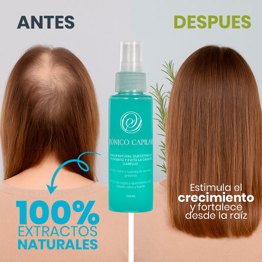 Tónico Capilar Anticaída y Anticaspa Natural SECRETOS | Crecimiento Rápido sin Grasitud