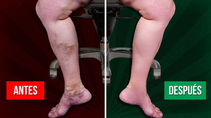 VEINS– Gel Alivio Venas y Várices 20g