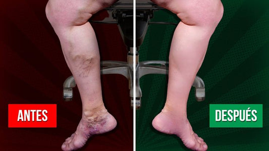 VEINS– Gel Alivio Venas y Várices 20g