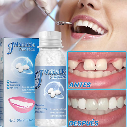 Solución temporal para dientes perdidos