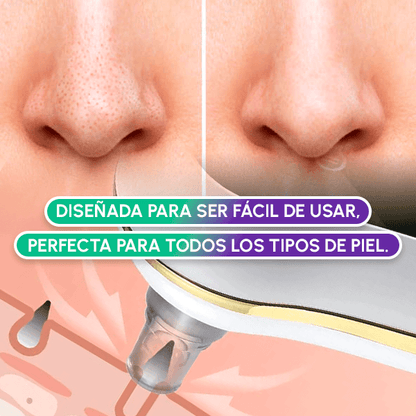 Extractor de espinillas + OBSEQUIO
