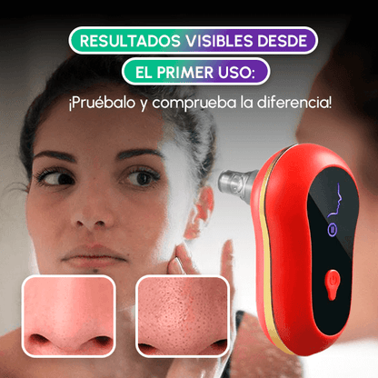 Extractor de espinillas + OBSEQUIO