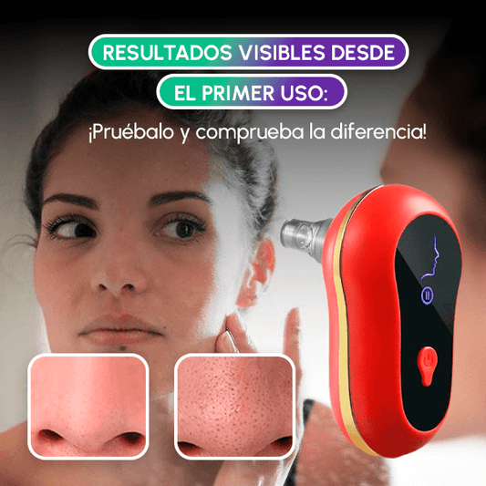 Extractor de espinillas + OBSEQUIO