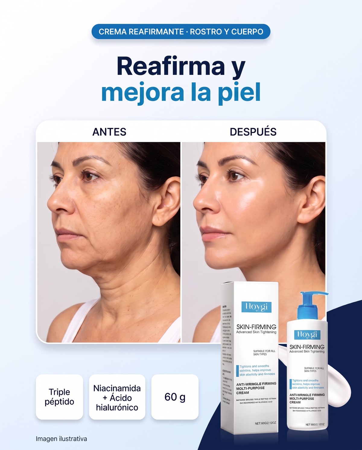 Crema Reafirmante Hoygi antes y después