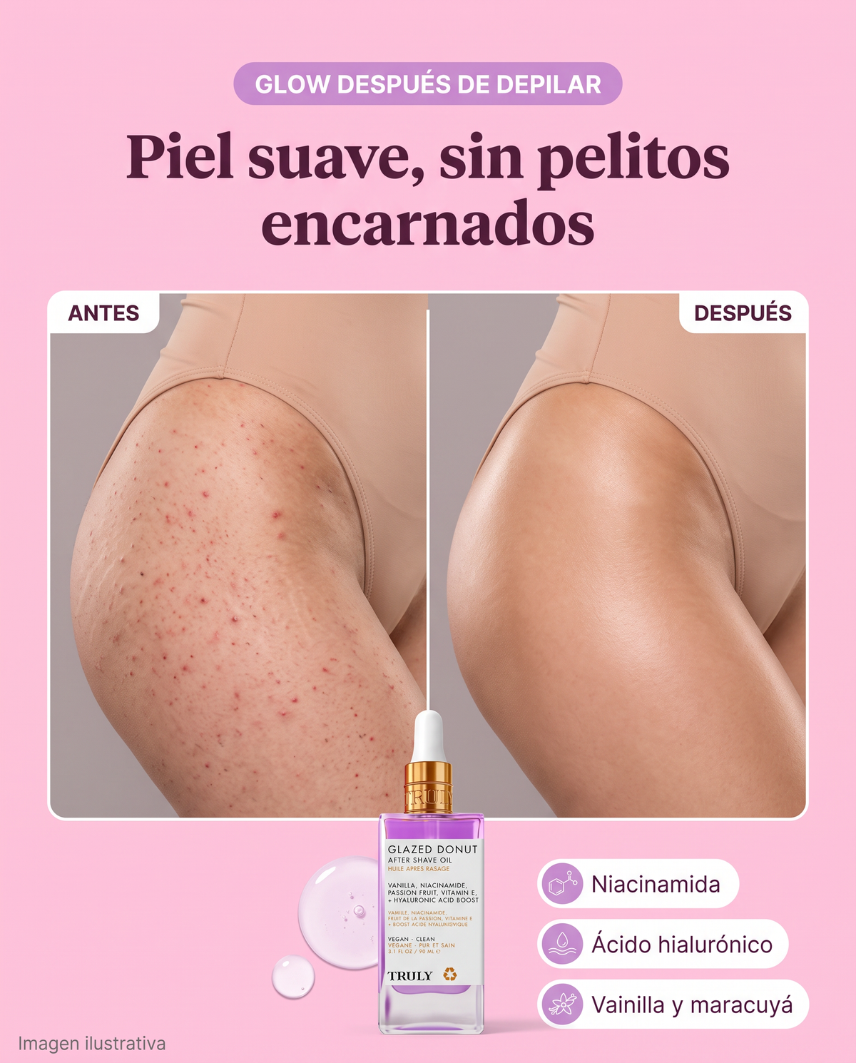 Imagen inicial Glazed