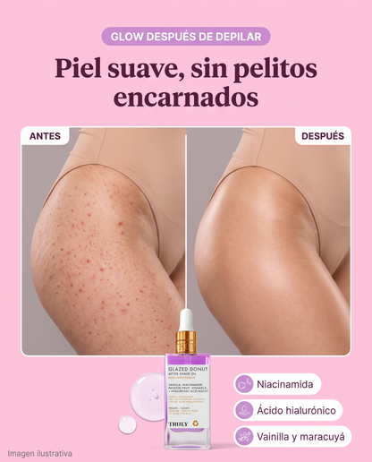Imagen inicial Glazed