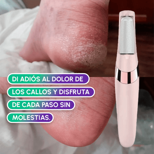 Tumba callos + Envío GRATIS